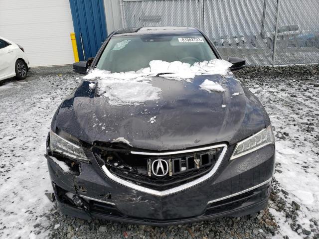 Photo 5 from auction – 2015 ACURA TLX TECH with VIN 19UUB1F59FA800174
