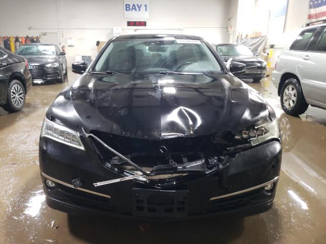 Photo 5 from auction – 2015 ACURA TLX ADVANC with VIN 19UUB2F74FA009591