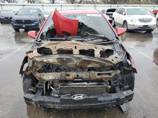 Photo 5 from auction – 2016 HYUNDAI ACCENT SE with VIN KMHCT5AE3GU289207