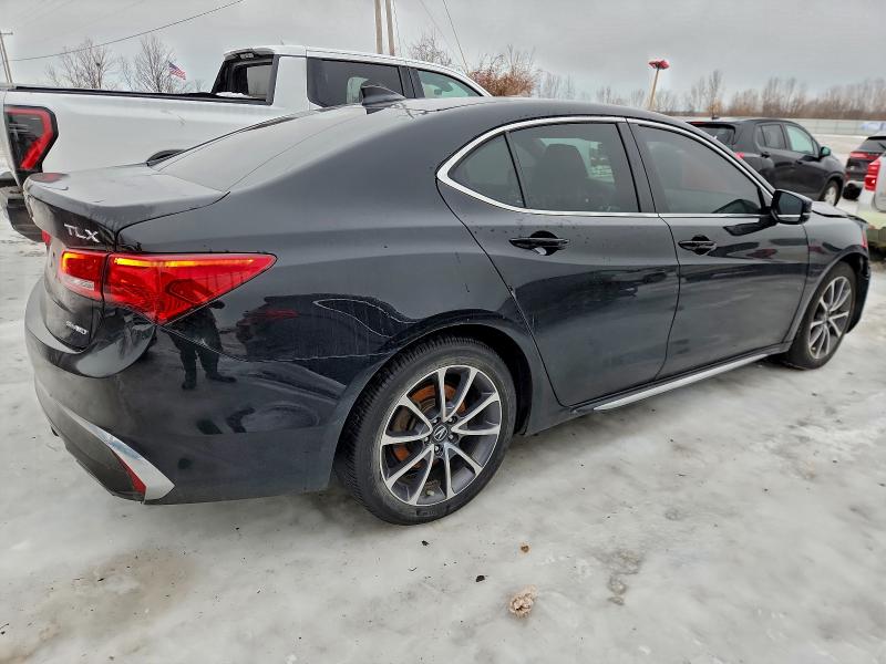 Photo 3 from auction – 2018 ACURA TLX TECH with VIN 19UUB3F54JA003559