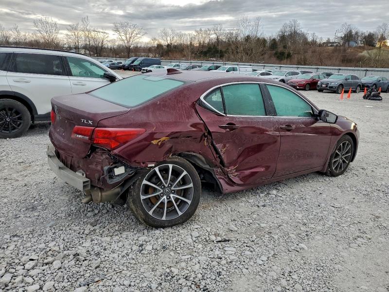 Photo 3 from auction – 2015 ACURA TLX TECH with VIN 19UUB2F57FA026125